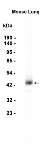 1 - Haptoglobin (9A7) Rabbit Monoclonal Antibody AP93789