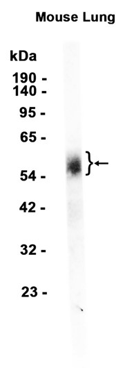 1 - uPA Receptor/U-PAR (1F11) Rabbit Monoclonal Antibody AP93791
