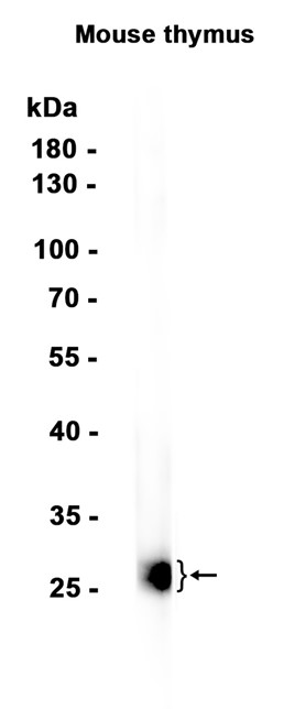 1 - CD8B (12I8) Rabbit Monoclonal Antibody AP93795