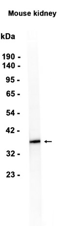 1 - Arg2 (3X6) Rabbit Monoclonal Antibody AP93796