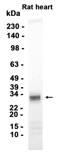 1 - IGFBP5 (18K8) Rabbit Monoclonal Antibody AP93797