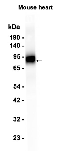 1 - CD39 (2I13) Rabbit Monoclonal Antibody AP93799