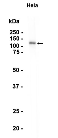 1 - FAM160A2 (11R14) Rabbit Monoclonal Antibody AP93803