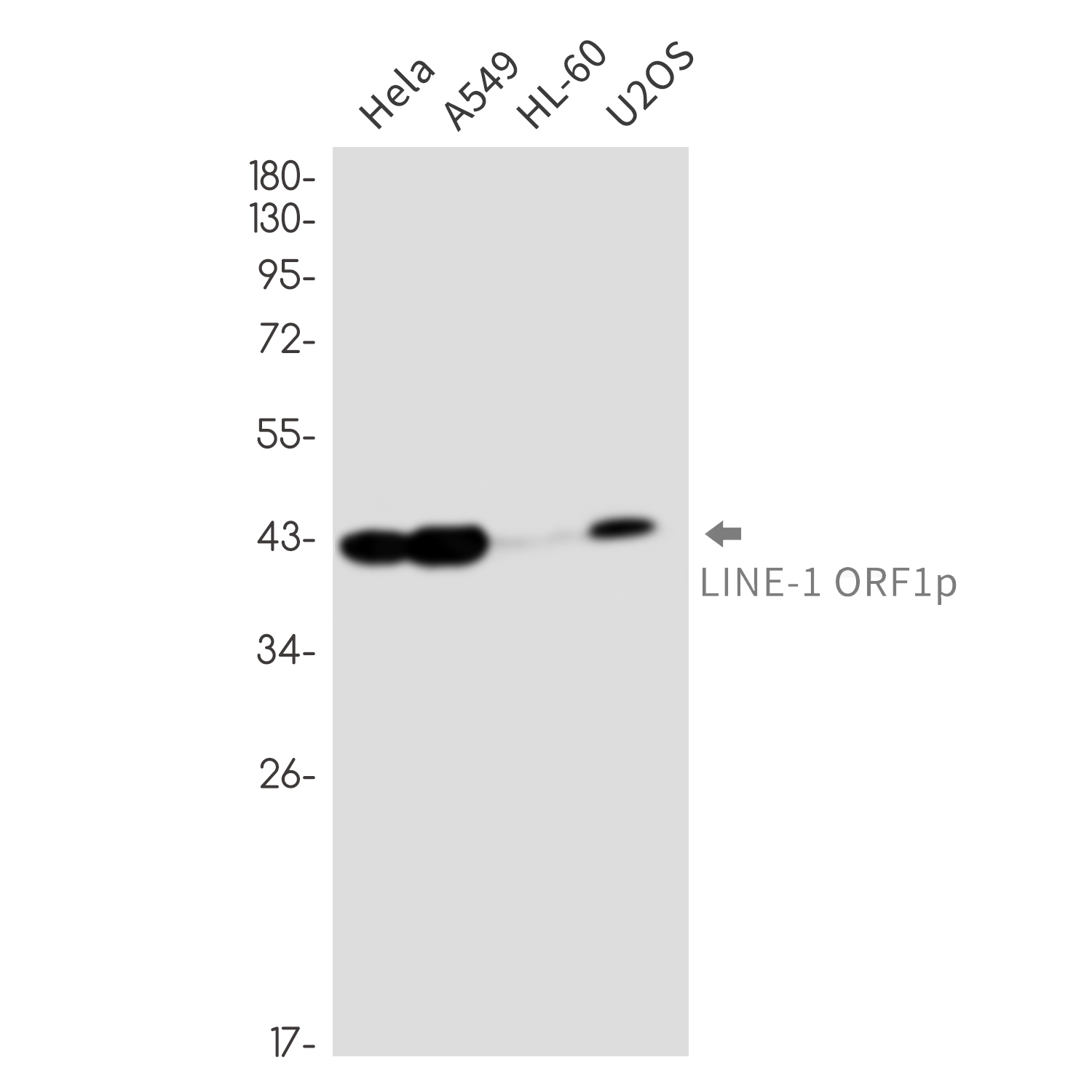 1 - LINE 1 ORF1p (4J7) Rabbit Monoclonal Antibody AP93804