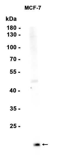 1 - FXYD3 (10Y16) Rabbit Monoclonal Antibody AP93805