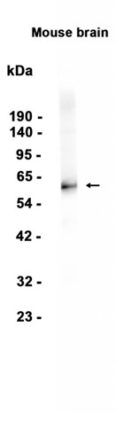1 - GAD65 (12K1) Rabbit Monoclonal Antibody AP93807