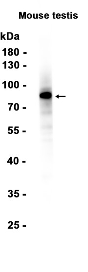 1 - DDX4/MVH (3H13) Rabbit Monoclonal Antibody AP93808