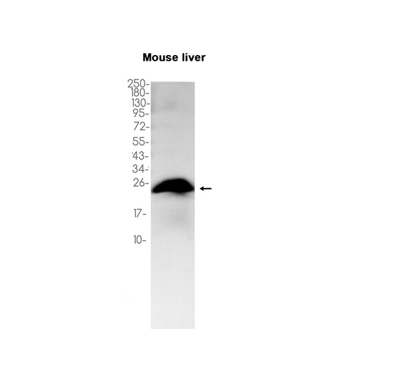 1 - Ferritin Heavy Chain (14L9) Rabbit Monoclonal Antibody AP93810
