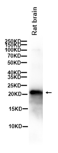 1 - Ferritin Heavy Chain (14L9) Rabbit Monoclonal Antibody AP93810