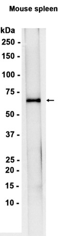 1 - TGFBI (10H5) Rabbit Monoclonal Antibody AP93812