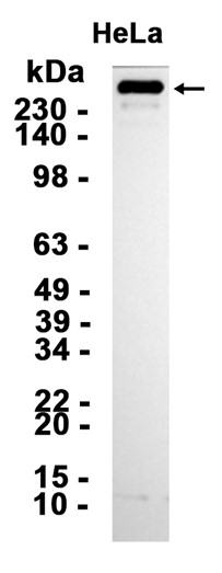 1 - Filamin C (9L15) Rabbit Monoclonal Antibody AP93814