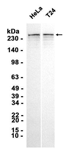 1 - EVPL (18V7) Rabbit Monoclonal Antibody AP93815