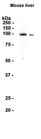 1 - Plasminogen (5V16) Rabbit Monoclonal Antibody AP93818