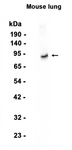 1 - CD105 (14B19) Rabbit Monoclonal Antibody AP93819