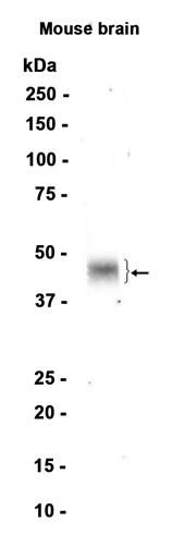 1 - Tissue Factor (13K19) Rabbit Monoclonal Antibody AP93820
