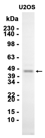 1 - Tmem27 (14D16) Rabbit Monoclonal Antibody AP93822