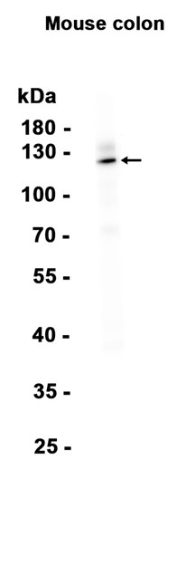 1 - GC-C (17B1) Rabbit Monoclonal Antibody AP93824
