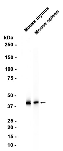 1 - CD38 (14S19) Rabbit Monoclonal Antibody AP93826