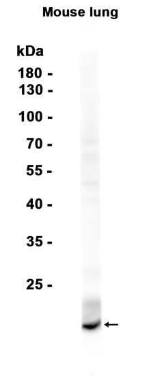 1 - Uteroglobin (17F17) Rabbit Monoclonal Antibody AP93827
