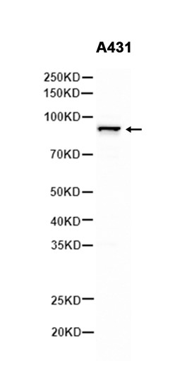 1 - PI3-Kinase p85 beta (2C3) Rabbit Monoclonal Antibody AP93828