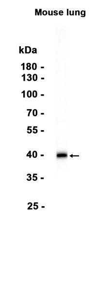 1 - Galectin-9 (14X15) Rabbit Monoclonal Antibody AP93829