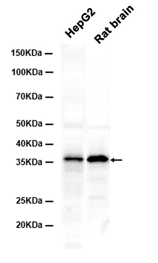 1 - Apolipoprotein E (4Y14) Rabbit Monoclonal Antibody AP93830
