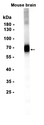 1 - EAAT2 (12G19) Rabbit Monoclonal Antibody AP93831