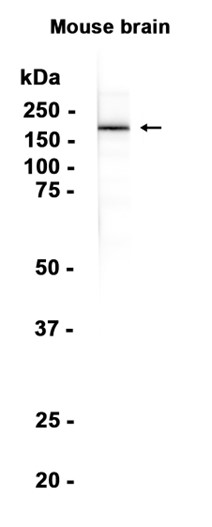 1 - NMDAR2B (5P4) Rabbit Monoclonal Antibody AP93834