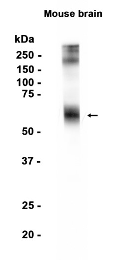 1 - EAAT2 (18V4) Rabbit Monoclonal Antibody AP93835