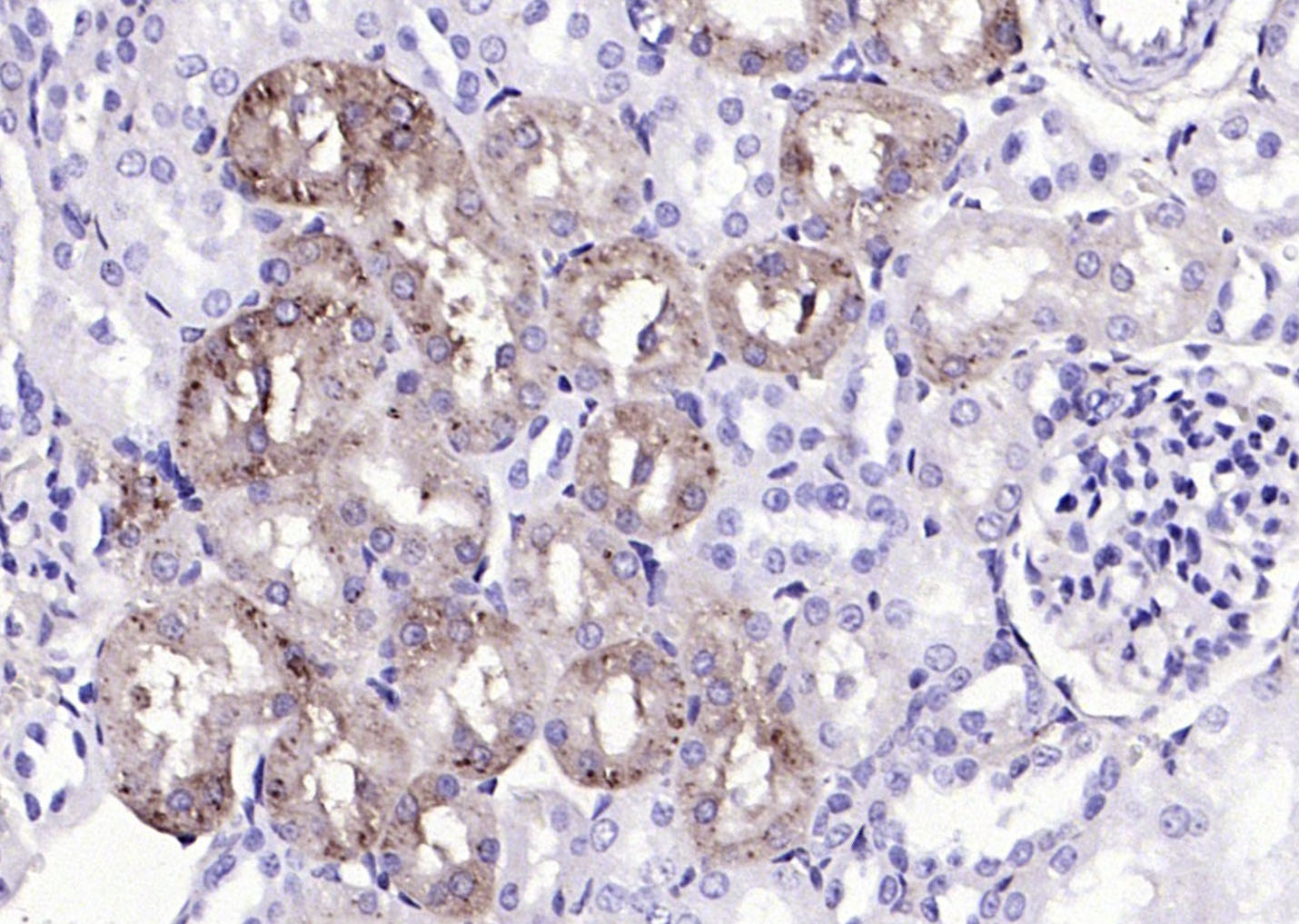 14 - TTR/Prealbumin Rabbit pAb AP94014