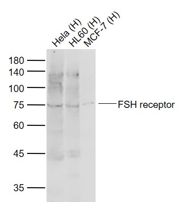 1 - FSH receptor Rabbit pAb AP94024