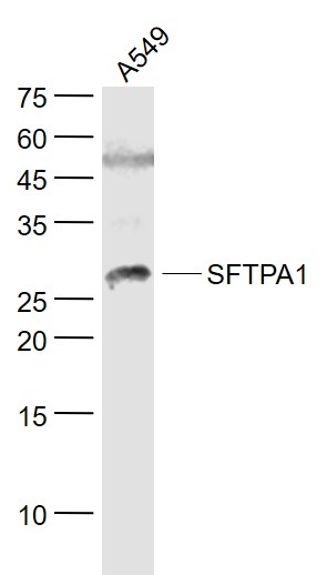 1 - SFTPA1 Rabbit pAb AP94027