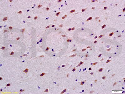14 - Neural Lineage Markers Antibody Assembly kit AP94038