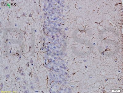 14 - Neural Lineage Markers Antibody Assembly kit AP94038