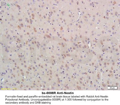 14 - Neural Lineage Markers Antibody Assembly kit AP94038