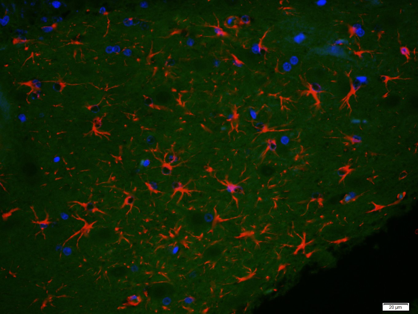 3 - Neural Lineage Markers Antibody Assembly kit AP94038