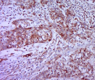 14 - Neural Lineage Markers Antibody Assembly kit AP94038