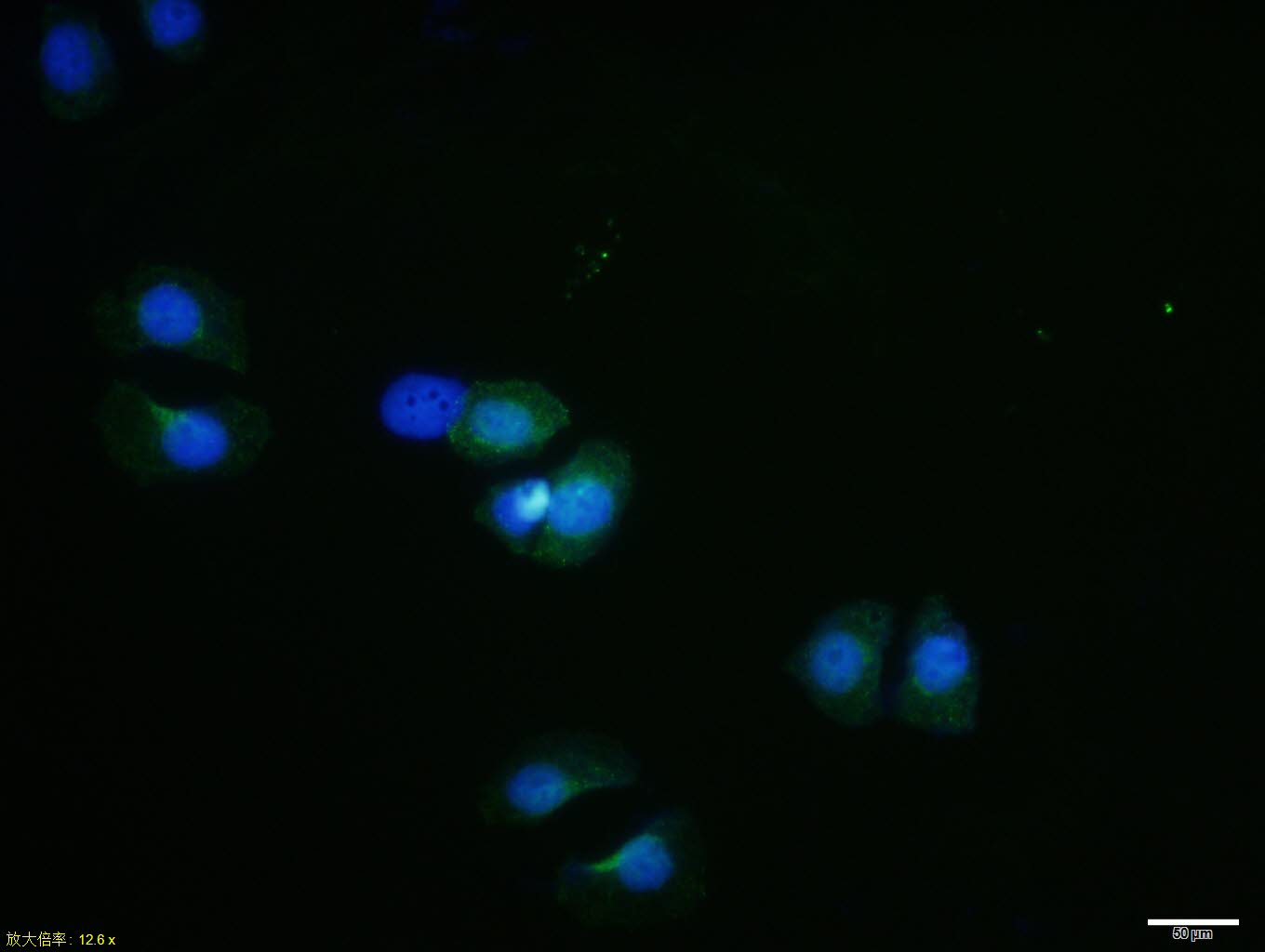1 - RPS6KA1 Rabbit pAb AP94056