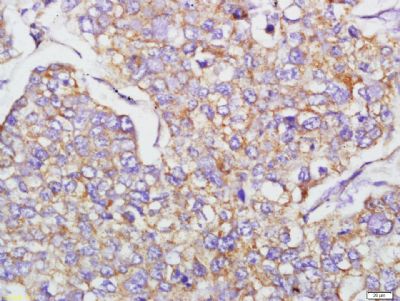 14 - EMT Research Antibody Assembly kit (E-Cadherin,N-Cadherin,Vimentin,Occludin,ZO-1) AP94100