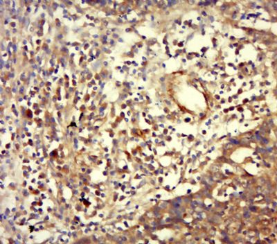 14 - EMT Research Antibody Assembly kit (E-Cadherin,N-Cadherin,Vimentin,Occludin,ZO-1) AP94100