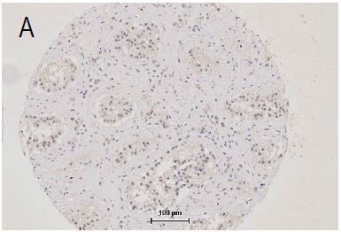 14 - EMT Research Antibody Assembly kit (E-Cadherin,N-Cadherin,Vimentin,Occludin,ZO-1) AP94100