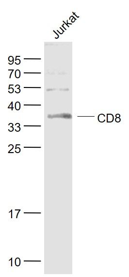 1 - Tumor Immunity Characterization Antibody Assembly kit AP94101