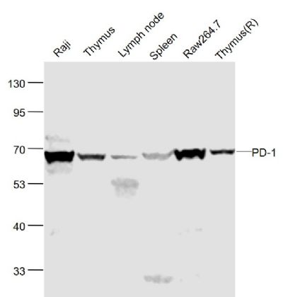 1 - Tumor Immunity Characterization Antibody Assembly kit AP94101
