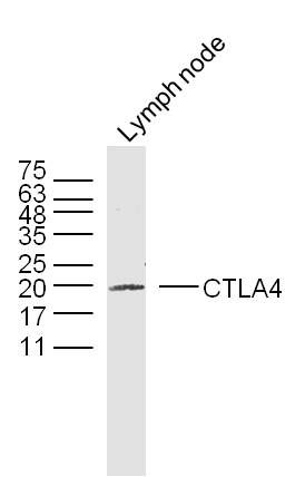 1 - Tumor Immunity Characterization Antibody Assembly kit AP94101
