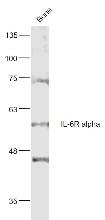 1 - IL-6R alpha Rabbit pAb AP94136