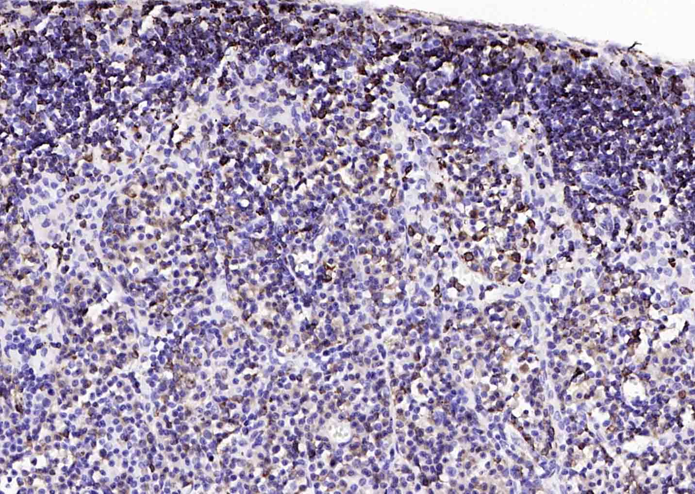 14 - CD74 Rabbit pAb AP94149