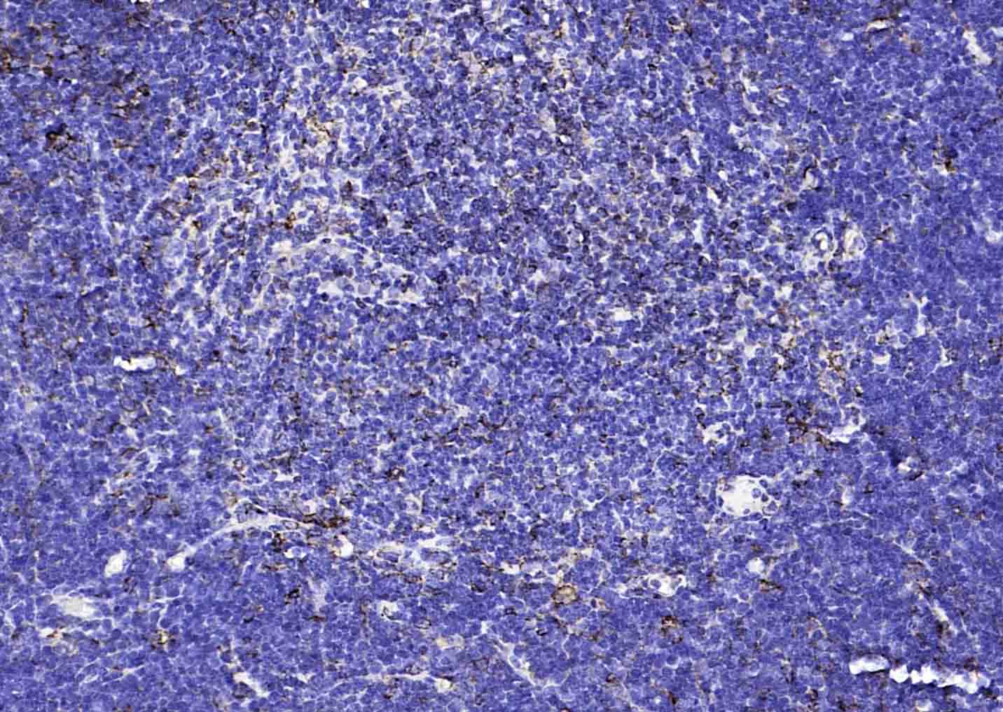 14 - CD74 Rabbit pAb AP94149