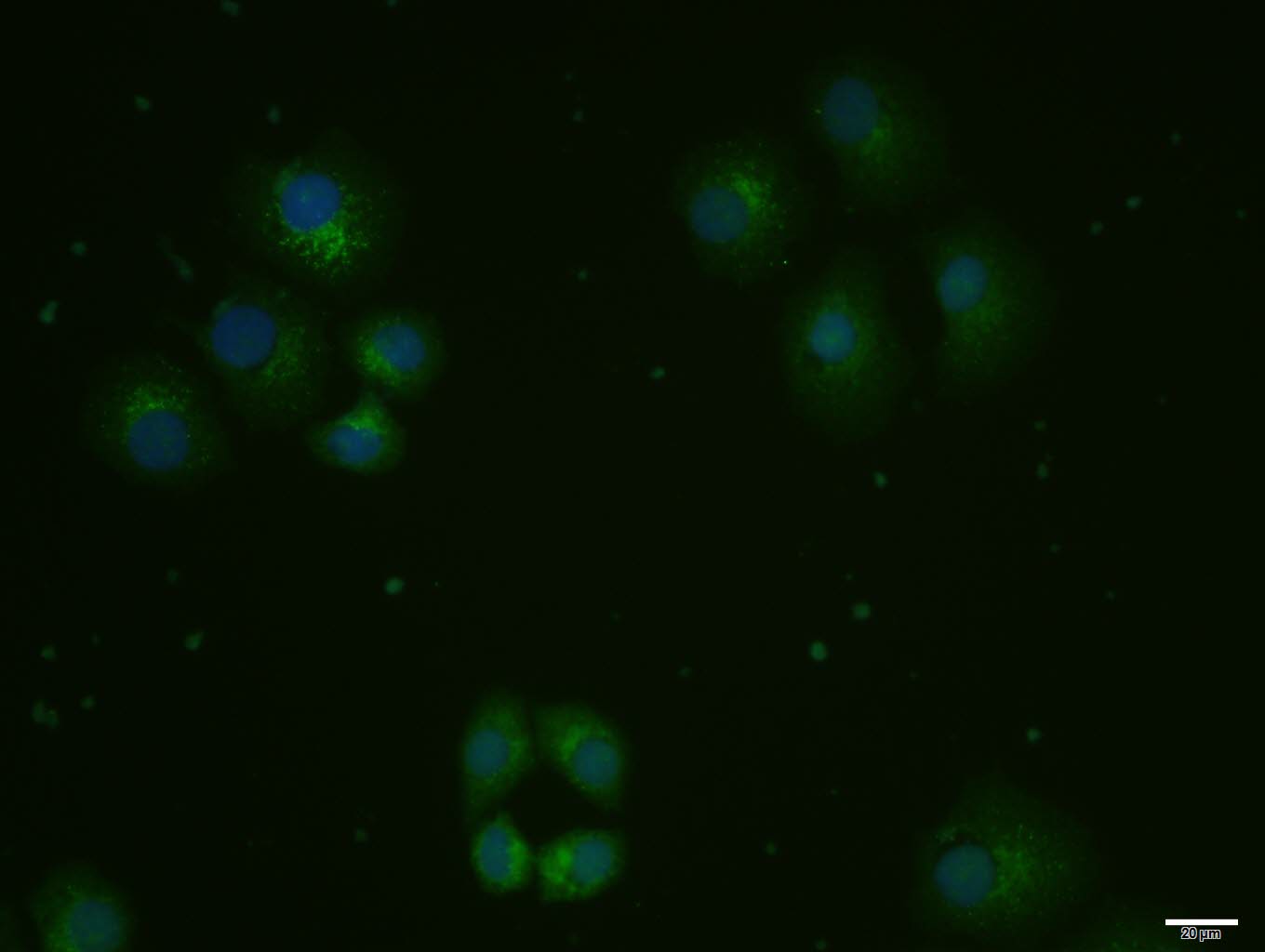 1 - ox-LDL Rabbit pAb AP94170