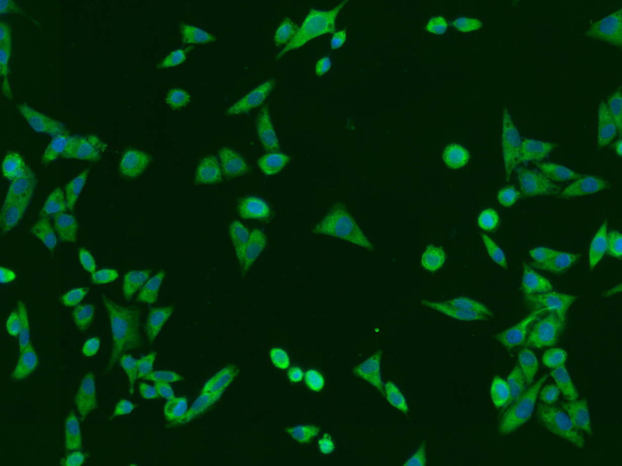 1 - RPS6KA1 Rabbit pAb AP94190