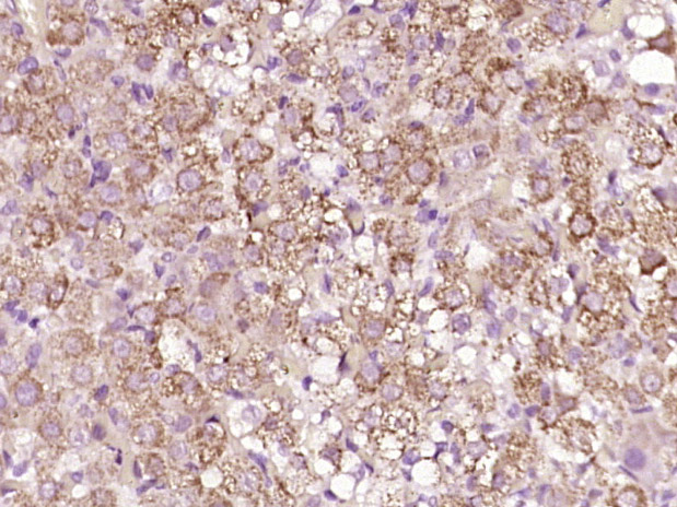 14 - HSD3B2 Rabbit pAb AP94271